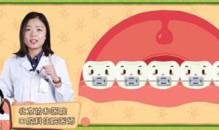 北京协和医院口腔科 北京协和医院口腔科